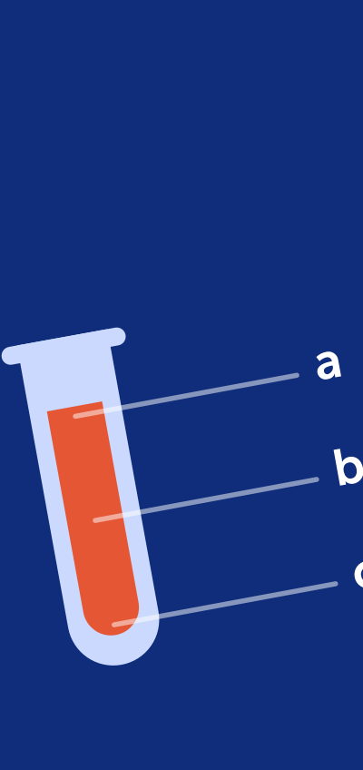 NCLEX tips in the form of checkmarks